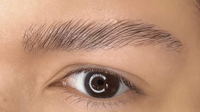 BrowsLiftingAfter-min