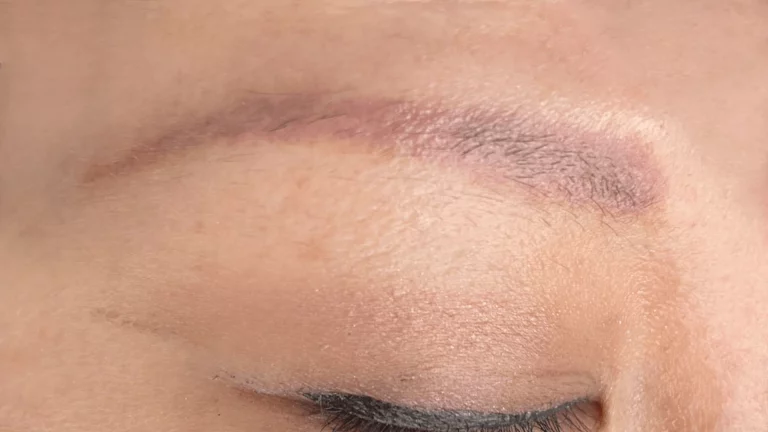 NanoRemoval After-min